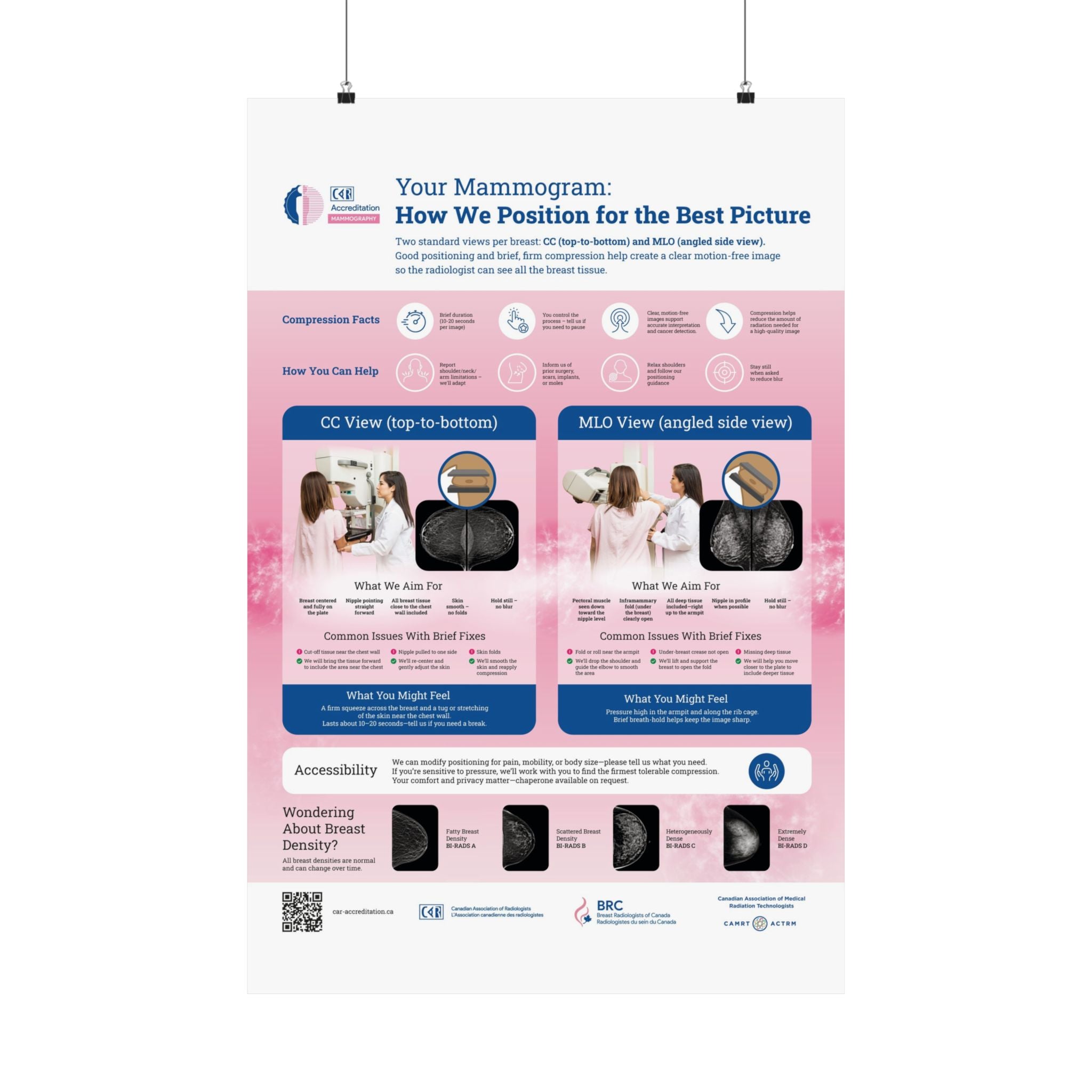 Mammography Positioning Poster - English